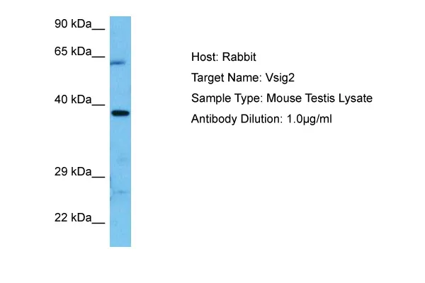 Vsig2 Rabbit Polyclonal Antibody - image 1