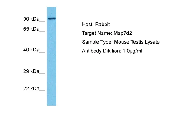 Map7d2 Rabbit Polyclonal Antibody - image 1