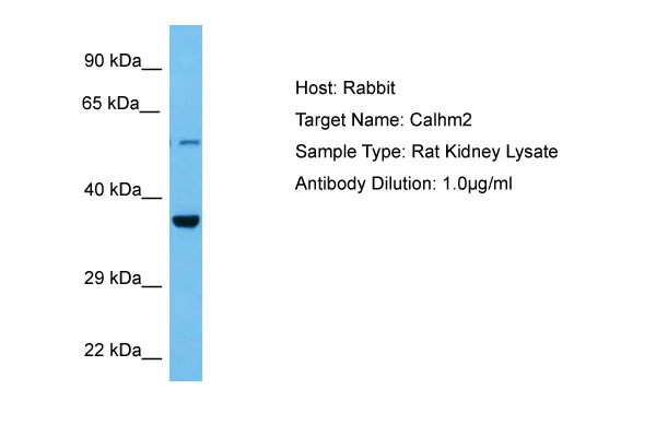 Calhm2 Rabbit Polyclonal Antibody - image 1