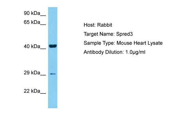 Spred3 Rabbit Polyclonal Antibody - image 1