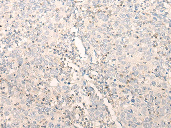 ELP4 Rabbit Polyclonal Antibody - image 1