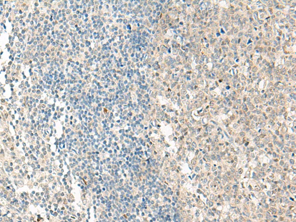 GPR7 (NPBWR1) Rabbit Polyclonal Antibody - image 1