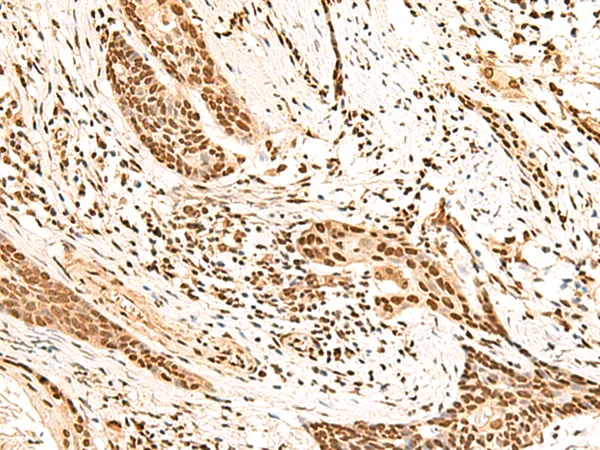 HOXC13 Rabbit Polyclonal Antibody - image 1