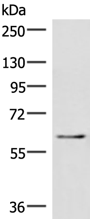 IRF2BP2 Rabbit Polyclonal Antibody - image 1