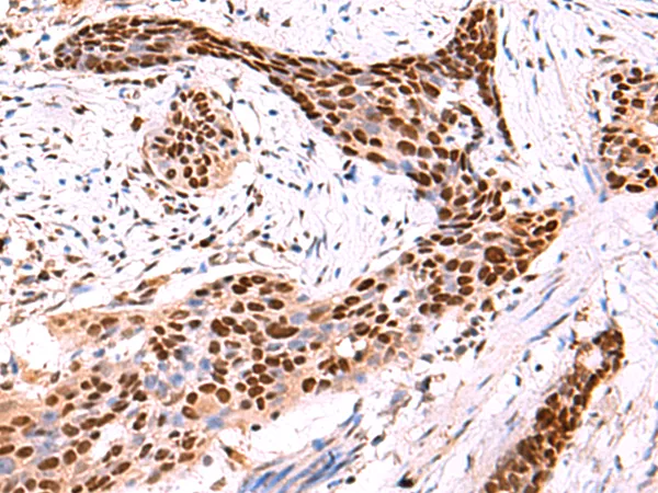 SOX2 Rabbit Polyclonal Antibody - image 1