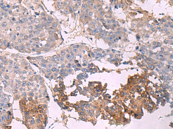 NIPSNAP1 Rabbit Polyclonal Antibody - image 1