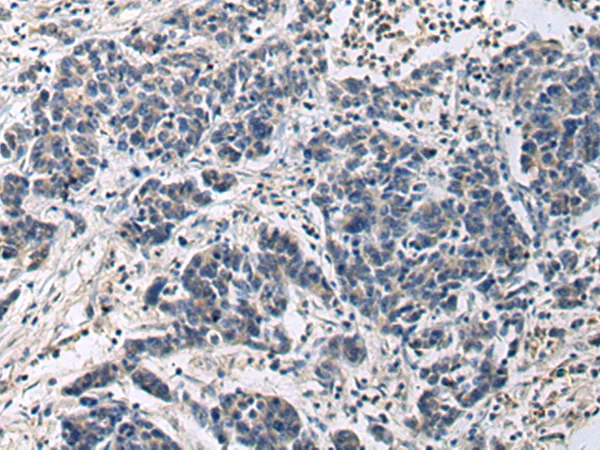 CNTF Rabbit Polyclonal Antibody - image 1