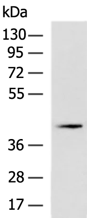 PRKACB Rabbit Polyclonal Antibody - image 1