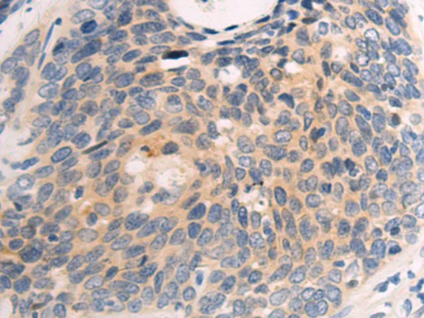 Neurotrophin 3 (NTF3) Rabbit Polyclonal Antibody - image 1
