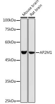 AP2M1 Rabbit Polyclonal Antibody - image 1