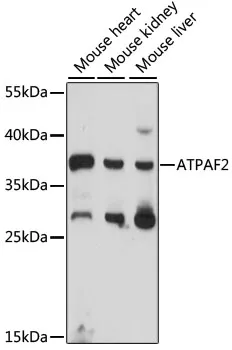 ATPAF2 Rabbit Polyclonal Antibody - image 1