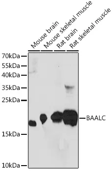 BAALC Rabbit Polyclonal Antibody - image 1