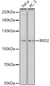 BRD2 Rabbit Polyclonal Antibody - image 1