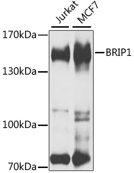 BRIP1 Rabbit Polyclonal Antibody - image 1