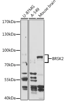 BRSK2 Rabbit Polyclonal Antibody - image 1