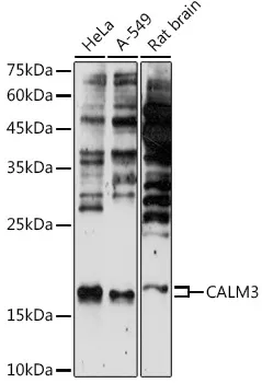 CALM3 Rabbit Polyclonal Antibody - image 1