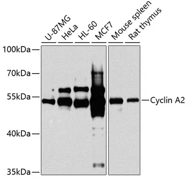 Cyclin A2 (CCNA2) Rabbit Polyclonal Antibody - image 1