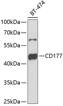 CD177 Rabbit Polyclonal Antibody - image 1
