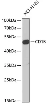 CD1B Rabbit Polyclonal Antibody - image 1