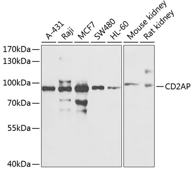 CD2AP Rabbit Polyclonal Antibody - image 1
