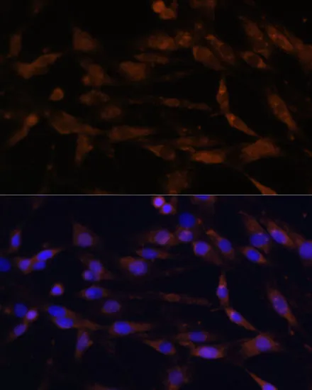 CD44 Rabbit Polyclonal Antibody - image 1