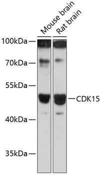 CDK15 Rabbit Polyclonal Antibody - image 1