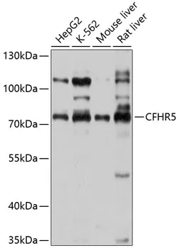CFHR5 Rabbit Polyclonal Antibody - image 1