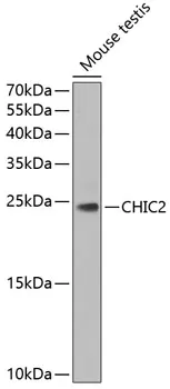 CHIC2 Rabbit Polyclonal Antibody - image 1