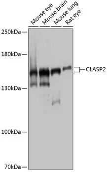 CLASP2 Rabbit Polyclonal Antibody - image 1
