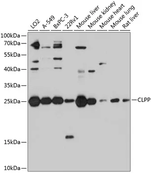 CLPP Rabbit Polyclonal Antibody - image 1