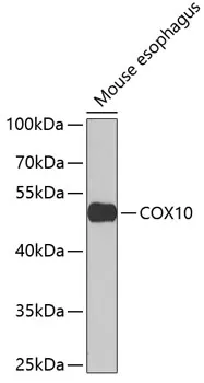 COX10 Rabbit Polyclonal Antibody - image 1