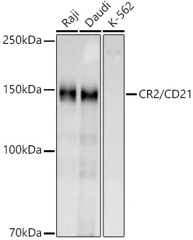 CD21 (CR2) Rabbit Polyclonal Antibody - image 1