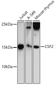 GM CSF (CSF2) Rabbit Polyclonal Antibody - image 1