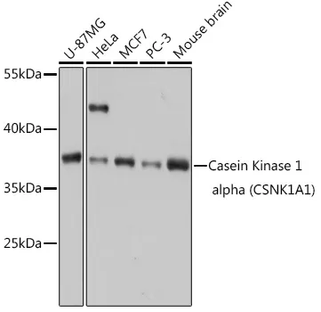 Casein Kinase 1 alpha (CSNK1A1) Rabbit Polyclonal Antibody - image 1