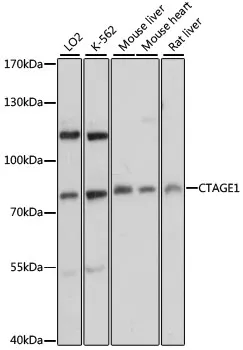 CTAGE1 Rabbit Polyclonal Antibody - image 1