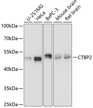 CTBP2 Rabbit Polyclonal Antibody - image 1