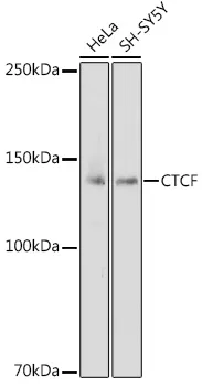 CTCF Rabbit Polyclonal Antibody - image 1