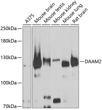 DAAM2 Rabbit Polyclonal Antibody - image 1