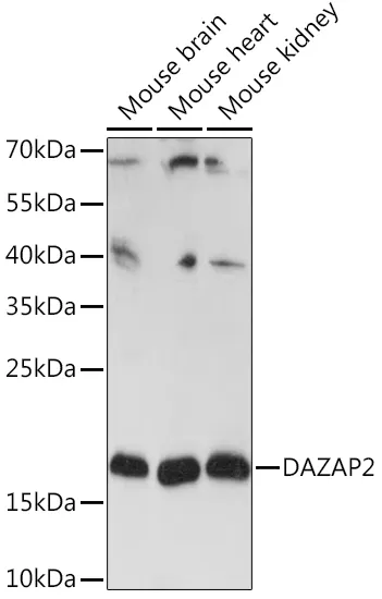 DAZAP2 Rabbit Polyclonal Antibody - image 1