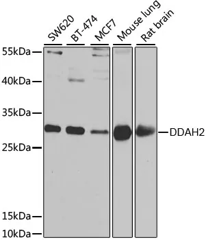 DDAH2 Rabbit Polyclonal Antibody - image 1