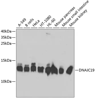 DNAJC19 Rabbit Polyclonal Antibody - image 1