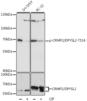 CRMP2 (DPYSL2) Rabbit Polyclonal Antibody - image 1