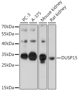 DUSP15 Rabbit Polyclonal Antibody - image 1