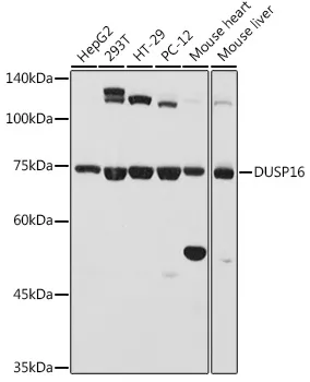 DUSP16 Rabbit Polyclonal Antibody - image 1