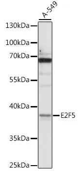 E2F5 Rabbit Polyclonal Antibody - image 1