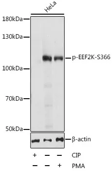 EEF2K Rabbit Polyclonal Antibody - image 1