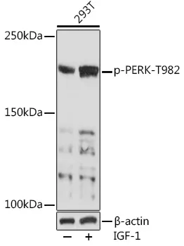 PERK (EIF2AK3) Rabbit Polyclonal Antibody - image 1
