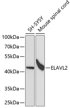 ELAVL2 Rabbit Polyclonal Antibody - image 1