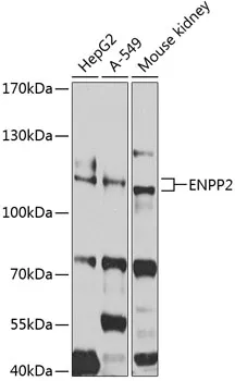 ENPP2 Rabbit Polyclonal Antibody - image 1