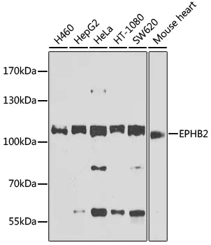 Eph receptor B2 (EPHB2) Rabbit Polyclonal Antibody - image 1